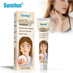 Крем для удаления витилиго Vitiligo Removal Cream