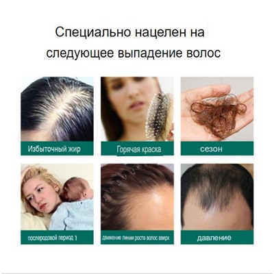 Спрей от выпадения волос из Имбиря 30 мл
